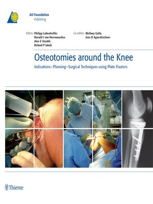 cover image of Osteotomies Around the Knee